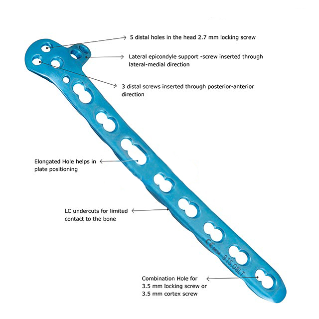 2.7/3.5mm Distal Humerus Locking Plate with Lateral Support, Left & Right