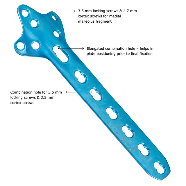 Cloverleaf Locking Plate