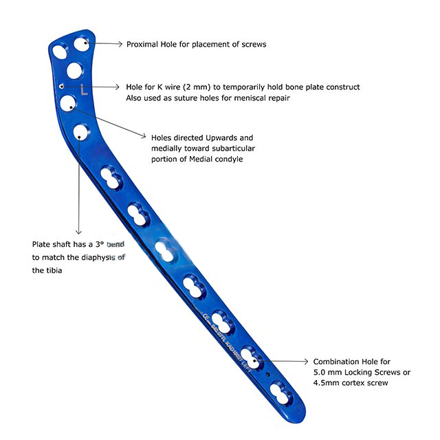 Locking Lateral Proximal Tibia Plate Left & Right