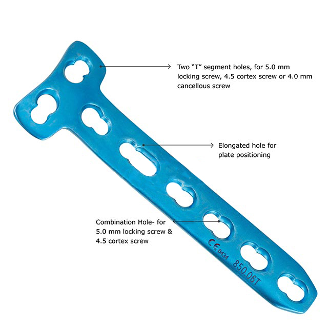 4.5mm Locking T-Plates