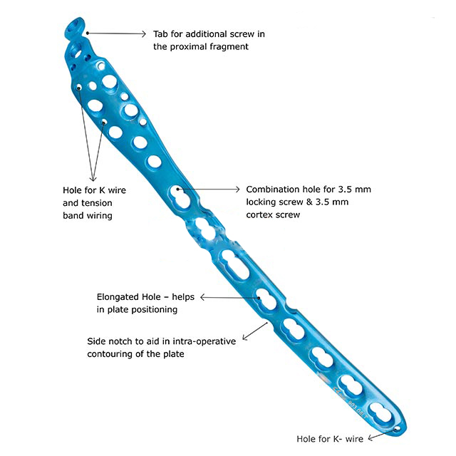 fixLOCK Olecranon Plate