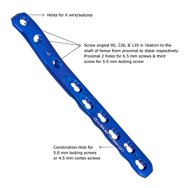 Proximal Femur Locking Plate (Right/Left)