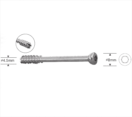 Cannulated Cancellous Screw 4.5mm, Partially Threaded, Hexagonal Socket