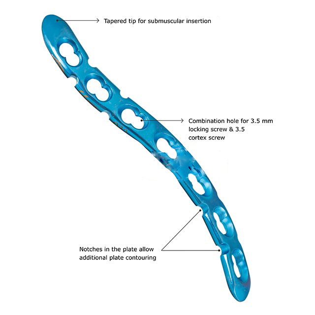 Clavicle ‘S’ Shaped Plate