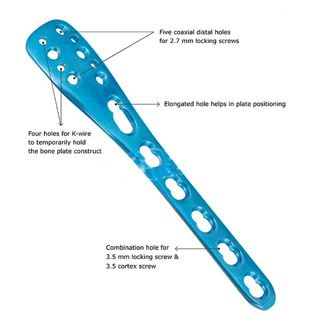 fixLOCK Distal Lateral Fibula Plate