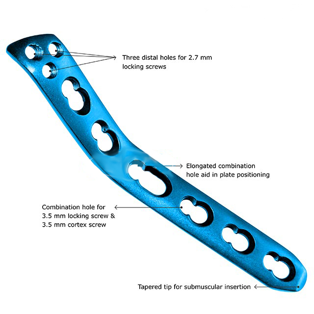 fixLOCK Medial Distal Humerus Plate