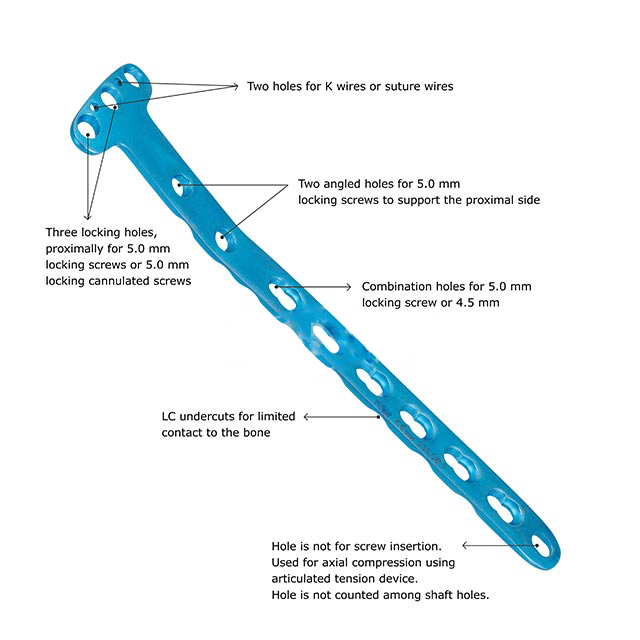 4.5 mm Medial Proximal Tibia Plate