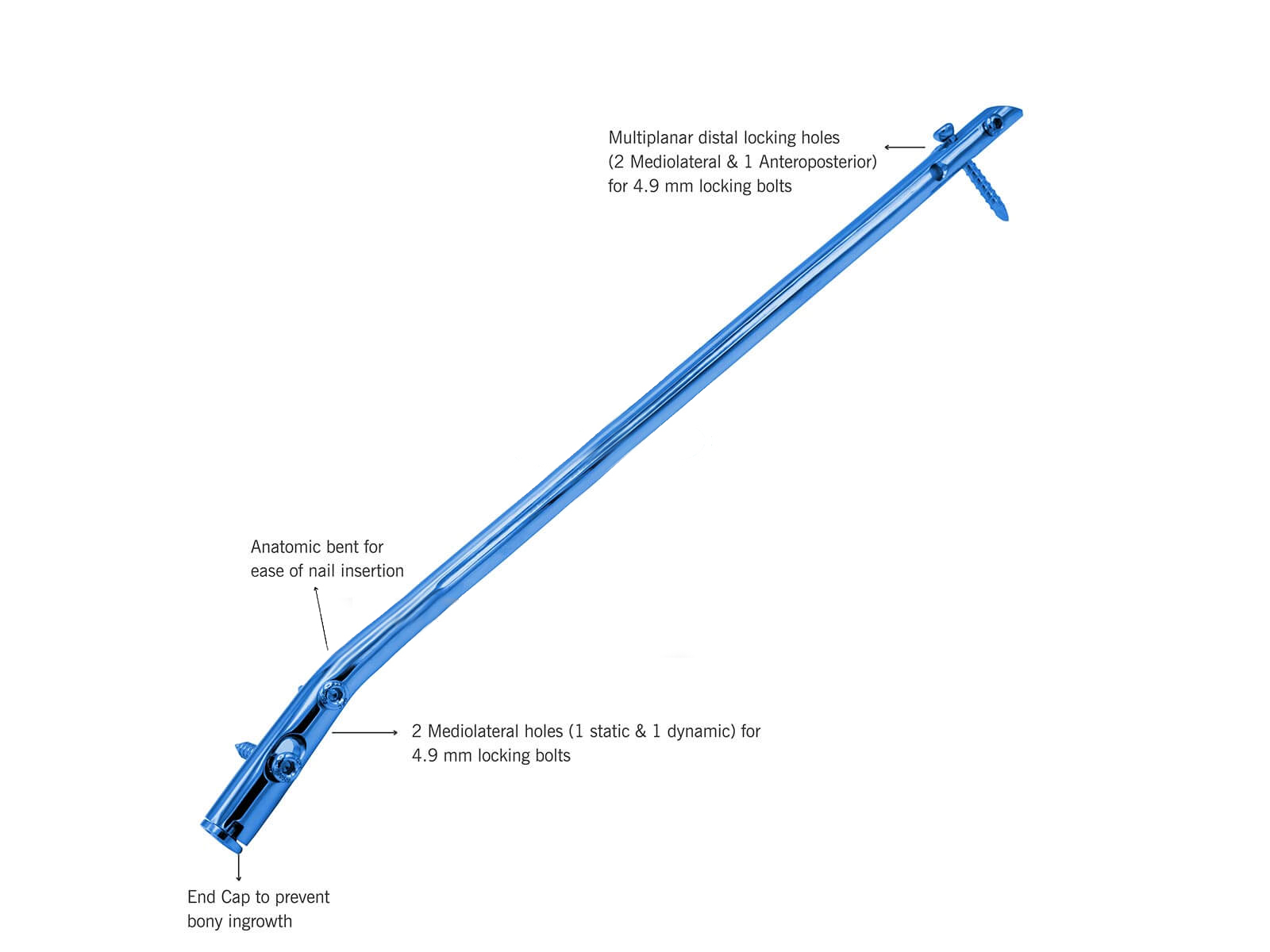 Unreamed Tibial Nails (Stainless Steel)