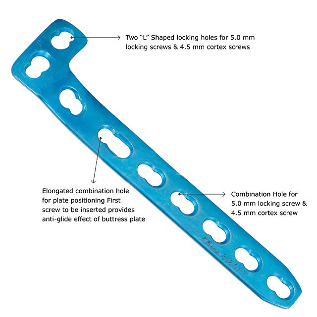 L-Buttress Locking Plate